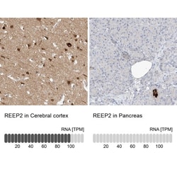 REEP2 Antibody, Novus Biologicals:Antibodies:Primary Antibodies
